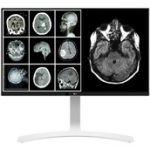 LG, 27" CLINICAL MONITOR, LED LCD 3840X2160 IPS TAA, FDA CLASS I, HDMI DP USB PIVOT HEIGHT ADJUST TILT VESA WHITE